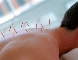 accupuncture back neck pain relief