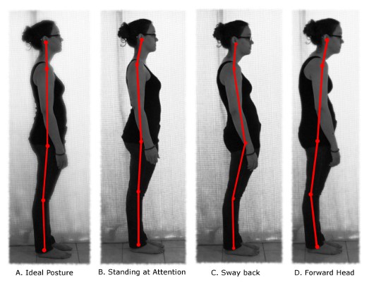 Posture analysis vancouver